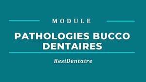 Pathologies Bucco Dentaires